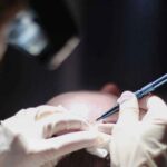 implanter FUE surgeon in Delhi