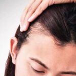 hair transplant women