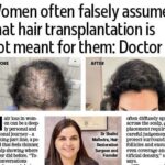 Hair transplants in delhi