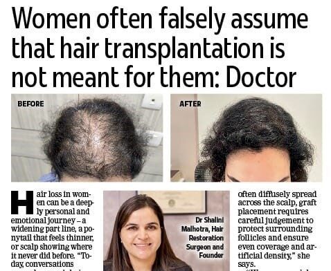 Is hair transplant an option for women?