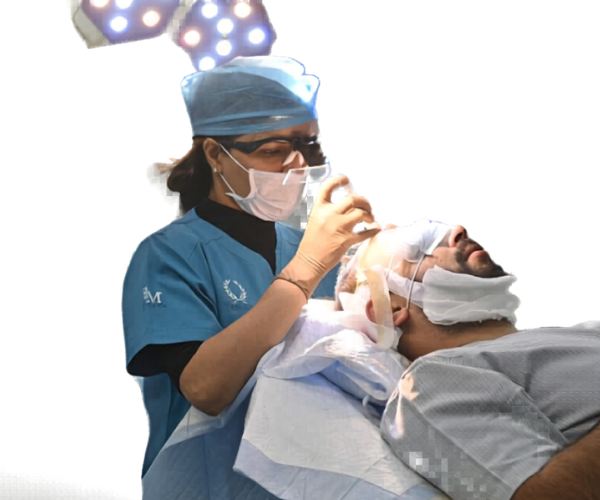 women hair transplant in delhi