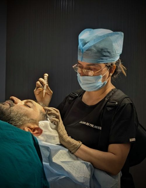 best hair transplant surgeon in delhi