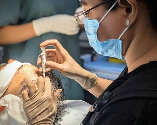 Why I choose to use implanters for every hair transplant