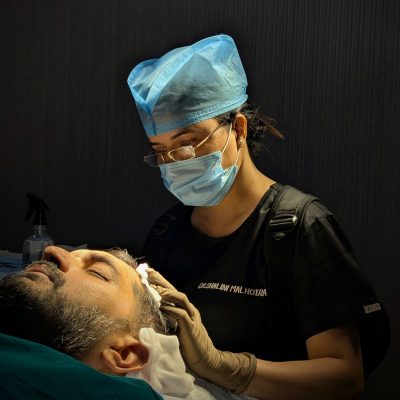 Advanced FUE hair transplant in Delhi procedure in progress