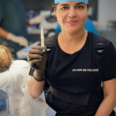 Cost of Unshaven Hair Transplant